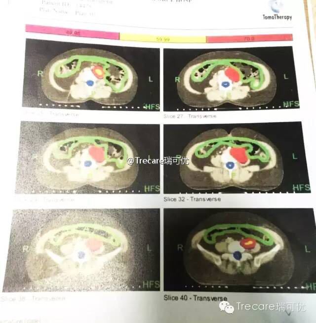 帝王动漫——国产ts紫苑在线观看，统治二次元的霸主，引领潮流的不朽传奇